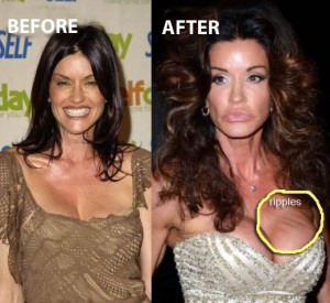 Janice-Dickinson-Plastic-Surgery-Before-After